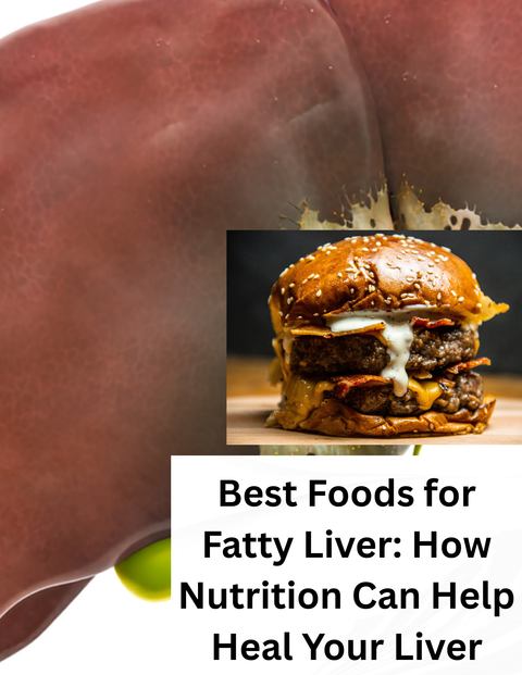 Best Foods for Fatty Liver: How Nutrition Can Help Heal Your Liver