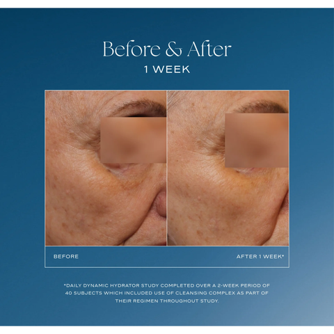 iS Clinical Daily Dynamic Hydrator