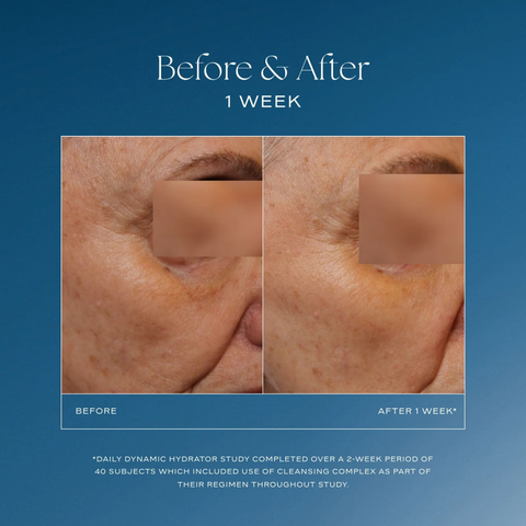 iS Clinical Daily Dynamic Hydrator Before and After