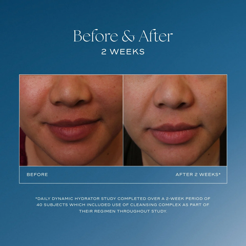 iS Clinical Daily Dynamic Hydrator Before and After