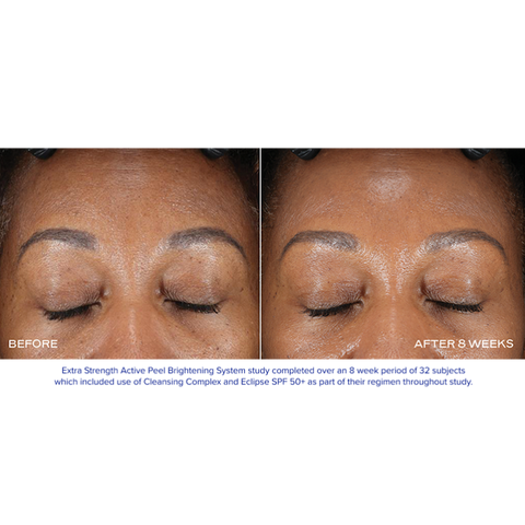 iS Clinical Extra Strength Active Peel Brightening System